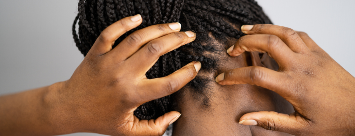 Scalp Itch Solved Mystery Tiny Black Dots Explained - iwcpbsk